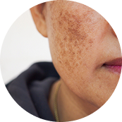 SKIN APPEARANCE