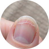 NAIL STRENGTH