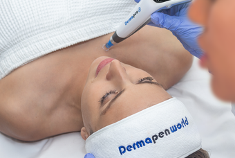Some Like It Hot: But Is It Worth It? Why It Pays to Go Heat-Free When It Comes To Microneedling