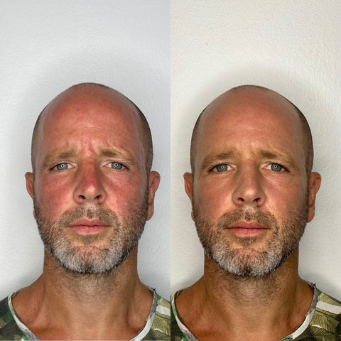 Before / After
